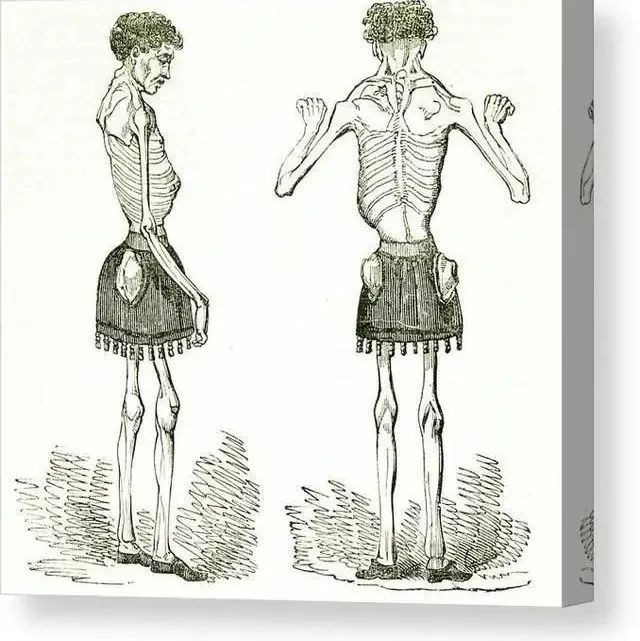 克劳德·安布罗斯·修拉：被称为“活着”的骷髅